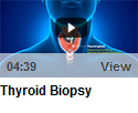 Thyroid Biopsy