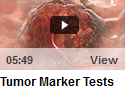 Tumor Marker Tests
